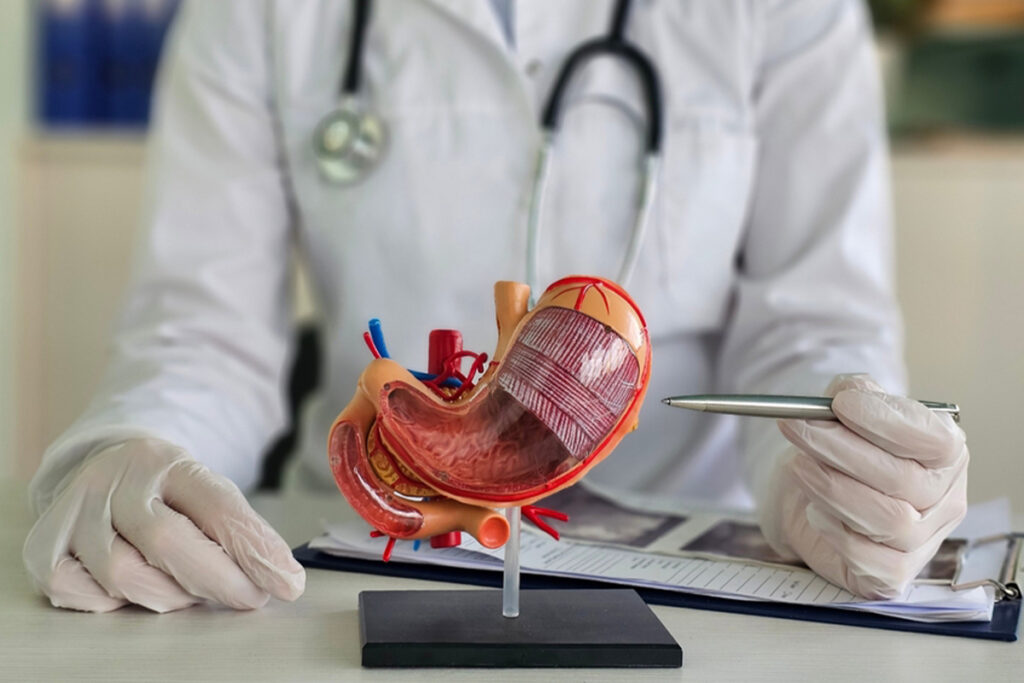 Gastrische Bypass Turkije